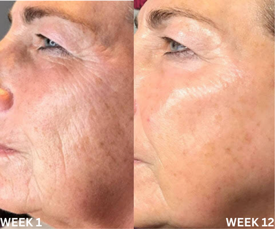 Velure Boost & Lift Duo